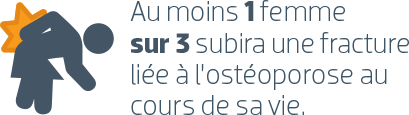 Au moins 1 femme sur 3 subira une fracture liee a losteoporose au cours de sa vie
